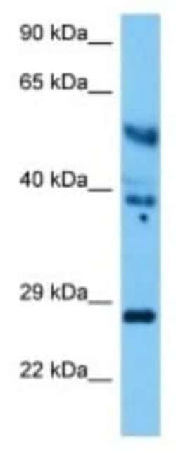 UCH-L4 Rabbit anti-Mouse, Polyclonal, Novus Biologicals 100 &mu;g | Buy Online | Novus Biologicals | Fisher Scientific
